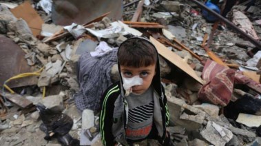 طفل فلسطينى مصاب جراء قصف الاحتلال