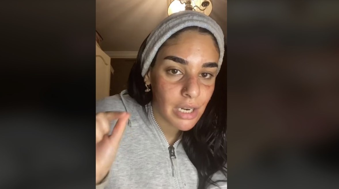 تريند "بلازما الدم" الذي انتشر بطريقة خاطئة تريند "بلازما الدم" الذي انتشر بطريقة خاطئة
