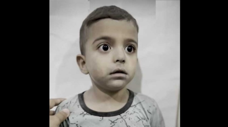 الطفل الفلسطيني محمد أبو لولي