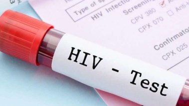 تحليل عدوي الإيدز