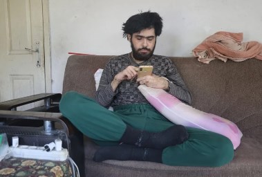حالة بارش أوزباي قبل الرعاية