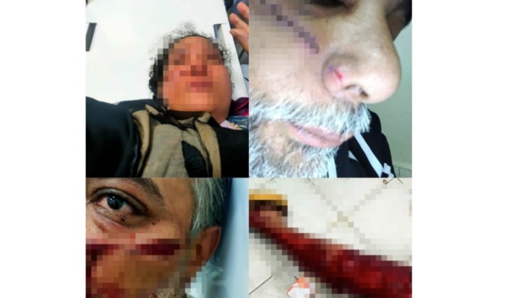 الزوجان بعد تعضهما لإصابات بالغة الزوجان بعد تعضهما لإصابات بالغة