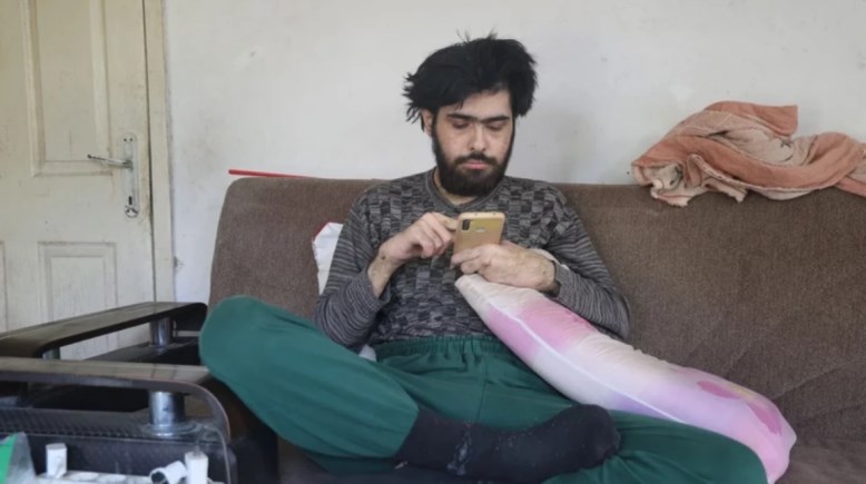 حالة بارش أوزباي قبل الرعاية حالة بارش أوزباي قبل الرعاية