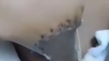 مفرمة داخل مطعم شهير تتسبب في بتر يد طفل ببورسعيد مفرمة داخل مطعم شهير تتسبب في بتر يد طفل ببورسعيد