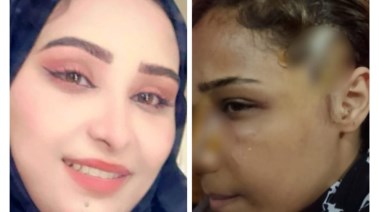 منار ضحية طليقها بأكتوبر 