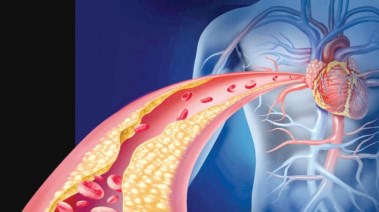 انسداد الشرايين ليلًا.. 7 إشارات خفية قد تهدد حياتك وأنت نائم