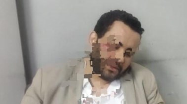 المحامي أسامة بعد أعتداء حراس الأكاديمية asc