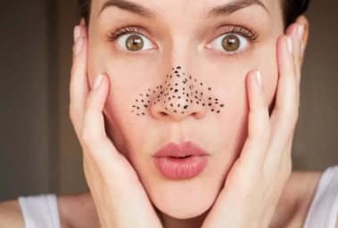 الرؤوس السوداء