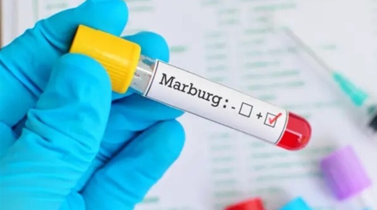 إثيوبيا تواجه فيروس ماربورغ
