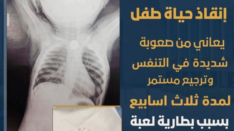 أشعة الرضيع