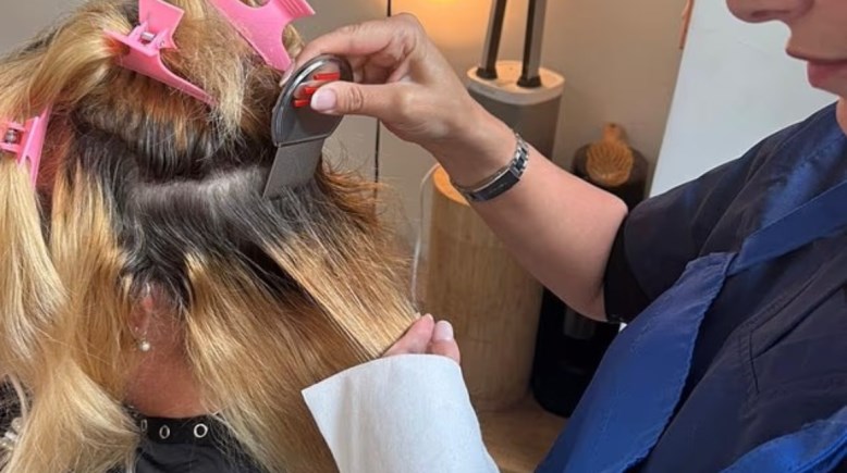 حالة القمل الشبحي للسيدات في فترة انقطاع الطمث