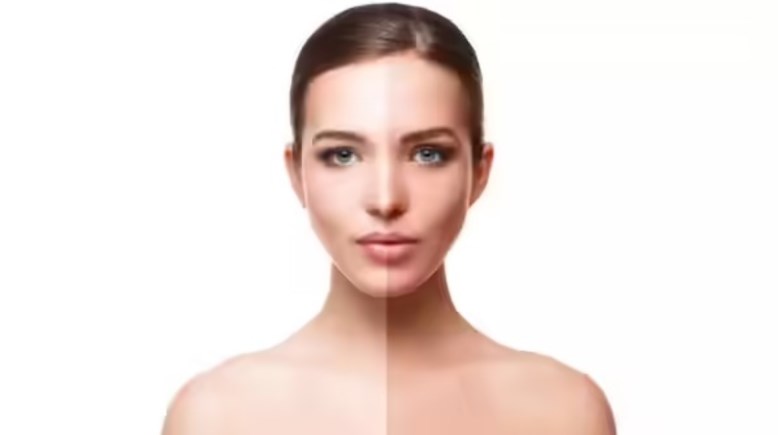 تفتيح البشرة