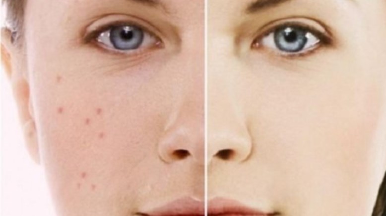 الرؤوس السوداء