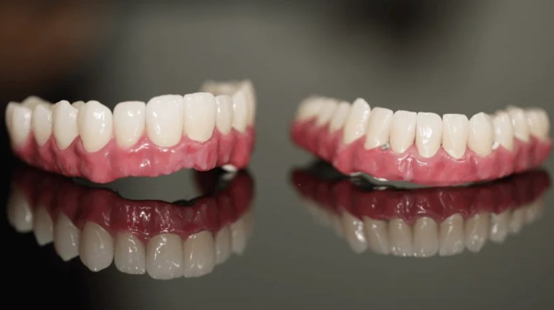 طقم اسنان -صورة أرشيفية 