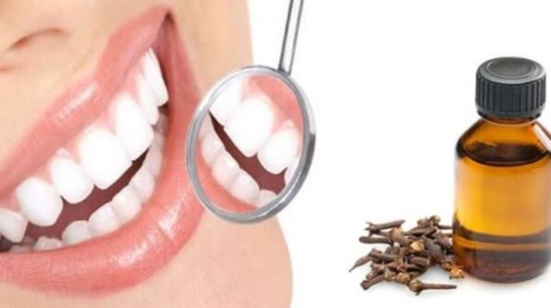 القرنفل والاسنان 