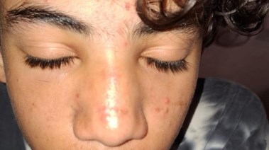 الطالب الذي تم الاعتداء عليه