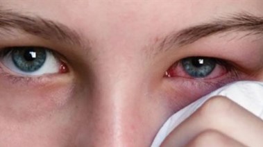 عمليات المياة البيضاء