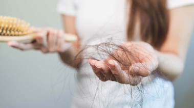 تساقط الشعر في الشتاء