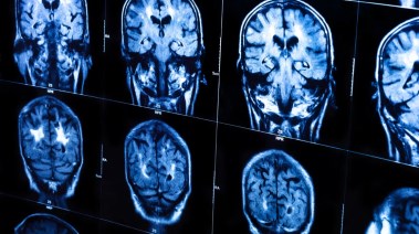 اختلاف الوظائف الدماغية بين النساء والرجال