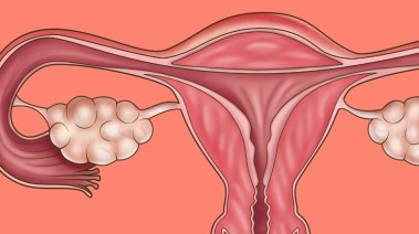 الجهاز التناسلي للسيدات