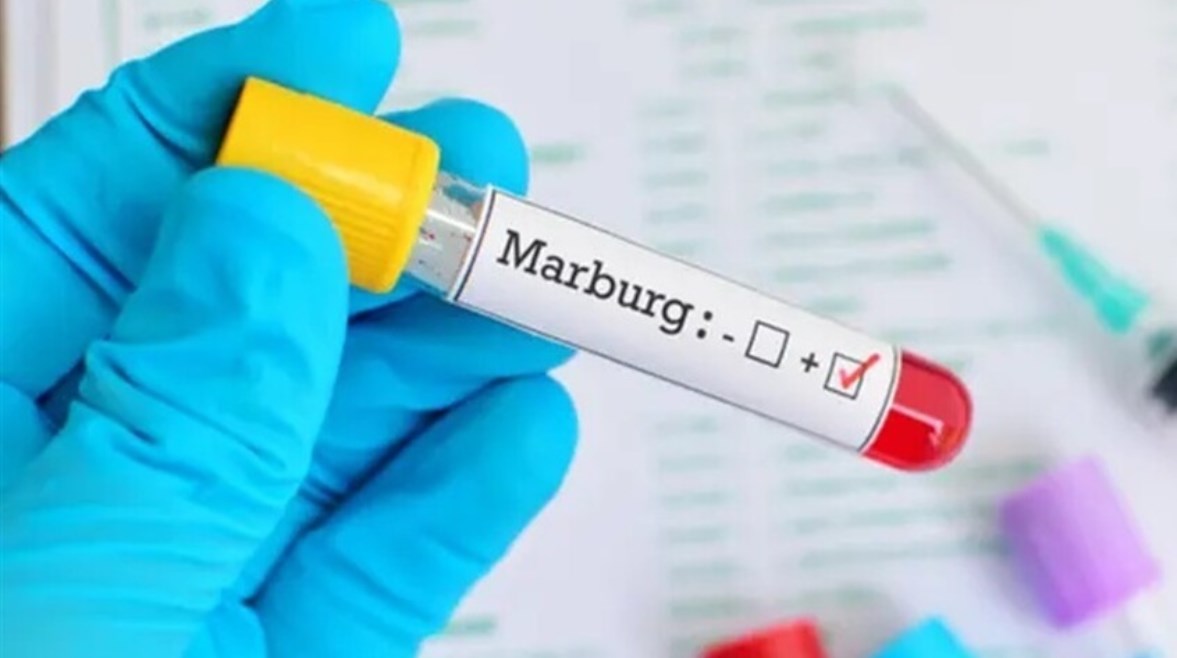 إثيوبيا تواجه فيروس ماربورغ