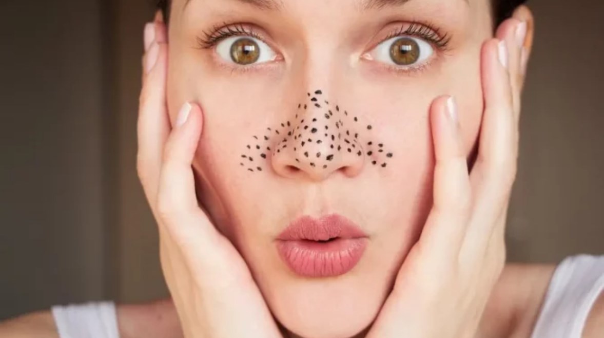 الرؤوس السوداء