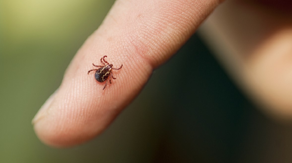 أول حالة وفاة في أمريكا بسبب مضاعفات نادرة لدغة قراد