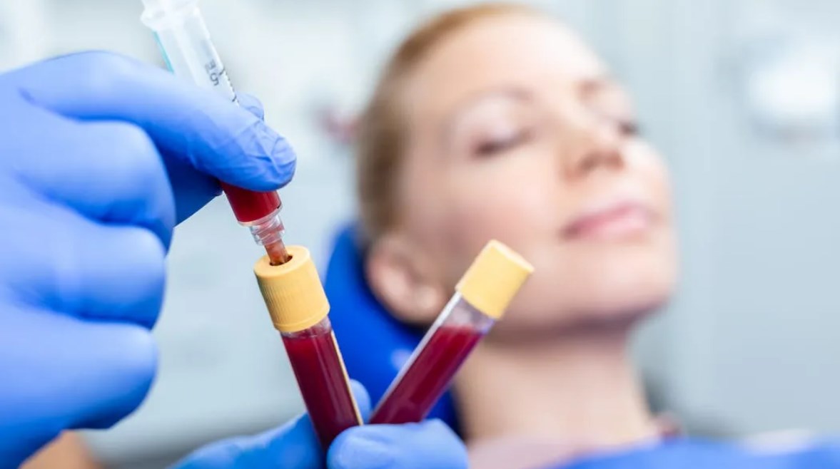 بلازما الدم