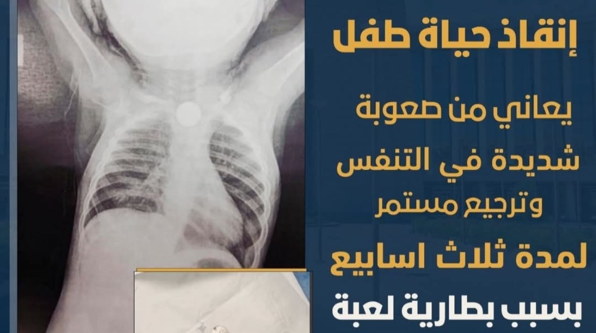 أشعة الرضيع