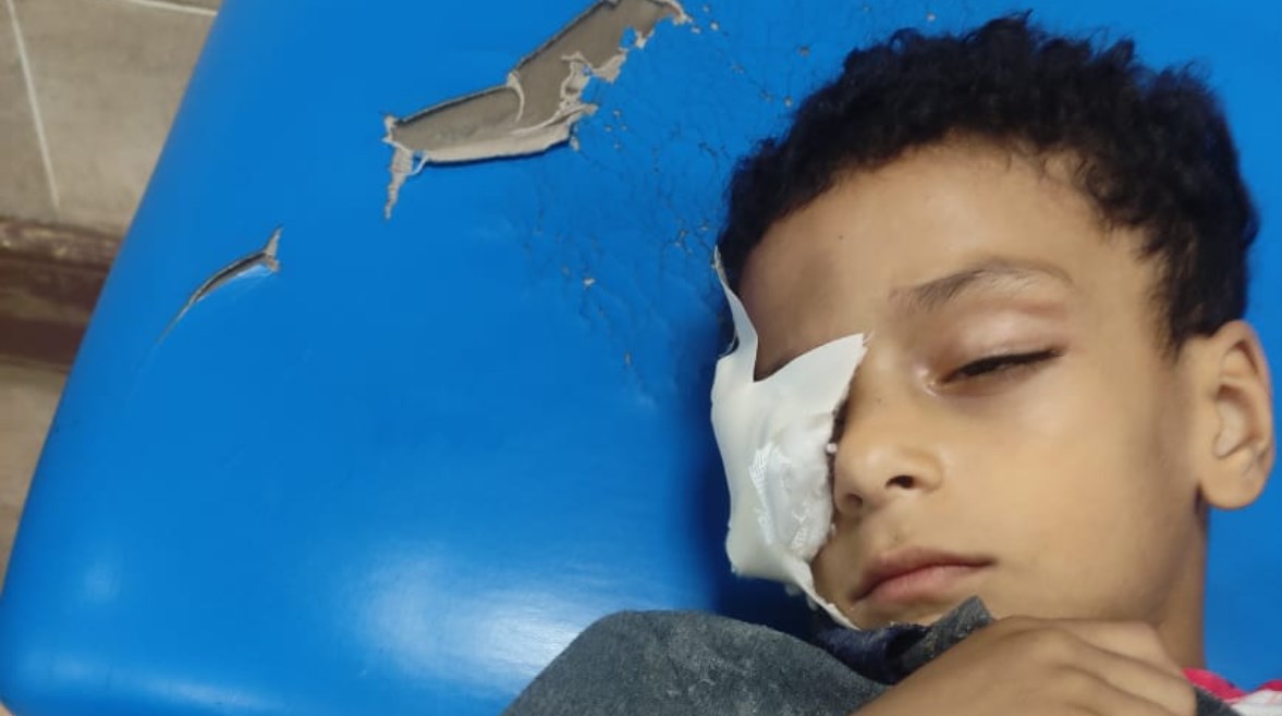 عمر التلميذ المصاب خاص لتليحراف مصر 