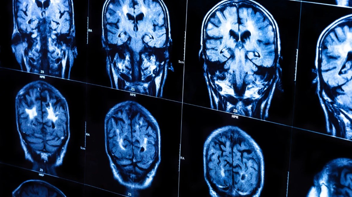 اختلاف الوظائف الدماغية بين النساء والرجال