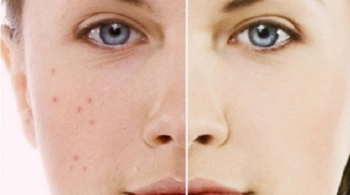 الرؤوس السوداء