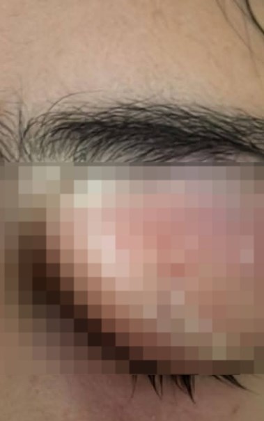 حالة المريضة