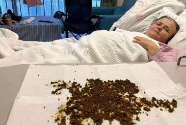 السيدة التركية بعد العملية