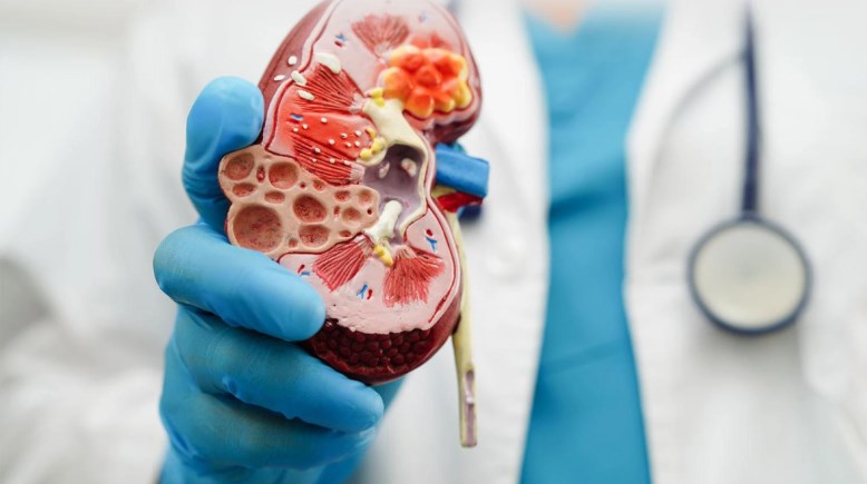 أمراض الكلى - تعبيرية