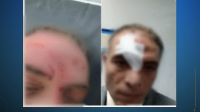 موكل المرشح المتعدى عليه