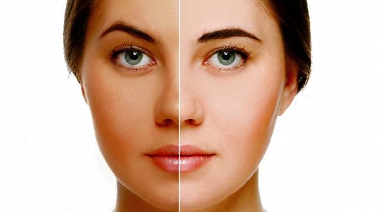 توحيد لون البشرة