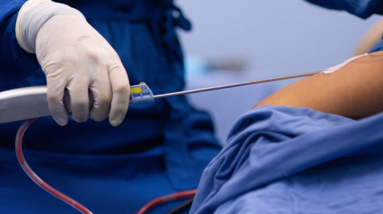 صورة تعبيرية 