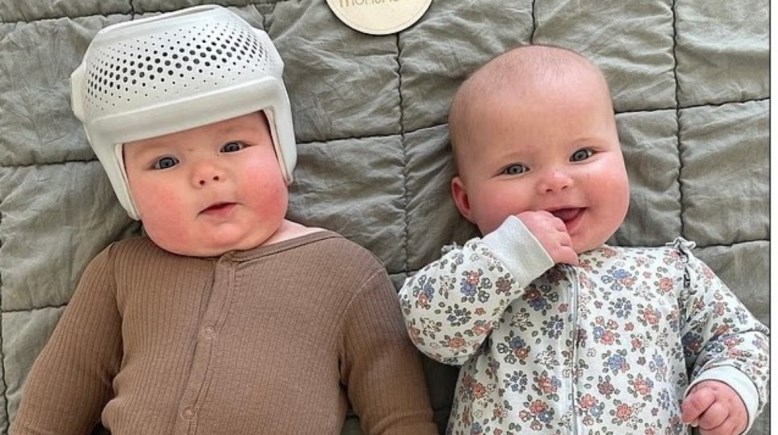 قوالب إعادة تشكيل الجمجمة