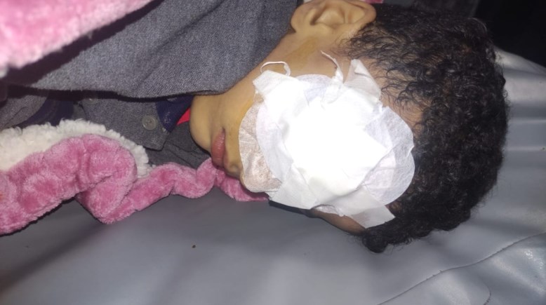 الطفل عمر الذي فقد عينه بسبب مدرسته 