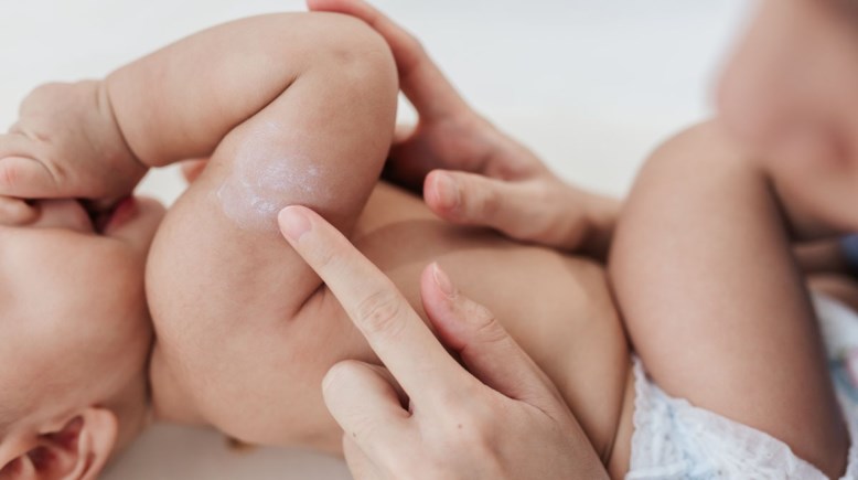 جفاف جلد الأطفال في الشتاء