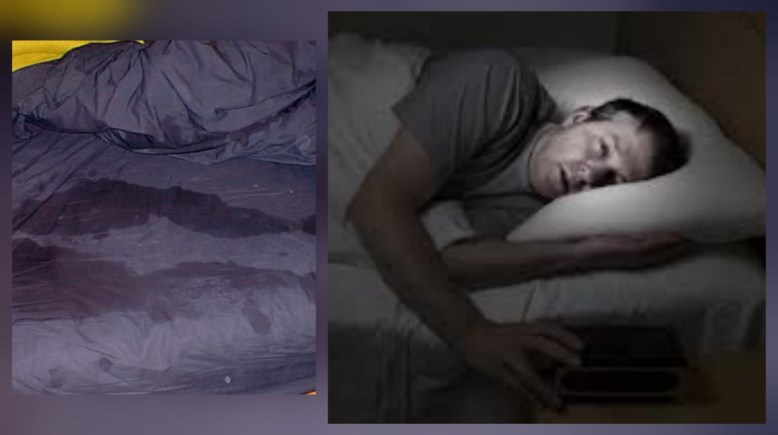 التعرق أثناء النوم