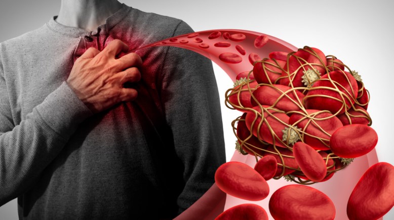 / انسداد الشرايين، أعراض خفية تظهر في المنزل