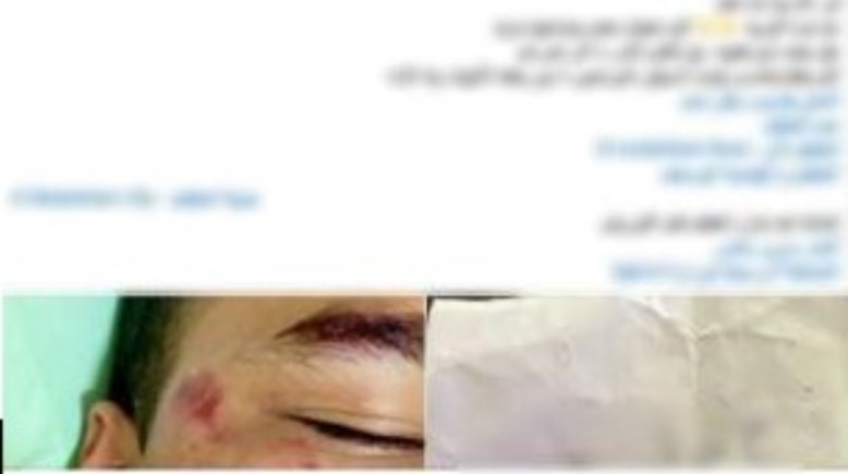  جانب من منشور دهس طالب في المقطم