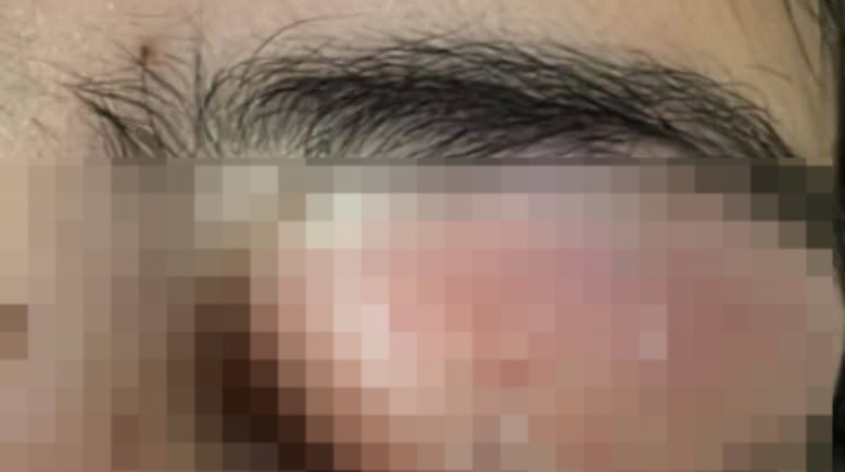 حالة المريضة