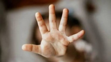 صورة تعبيرية