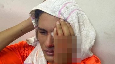 لاعب أبوقير المصاب