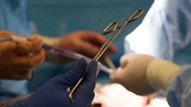 بيع الأعضاء- تعبيرية