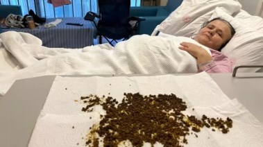 السيدة التركية بعد العملية