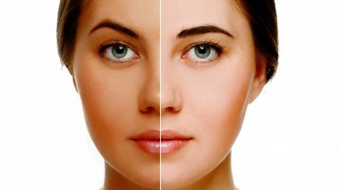 توحيد لون البشرة